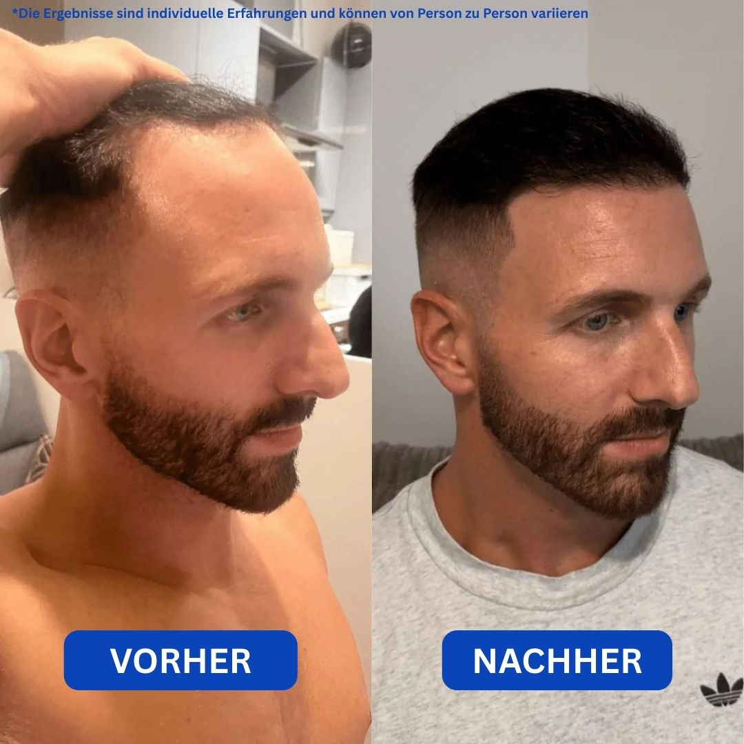 Regenyx™ – Serum für volles Haar