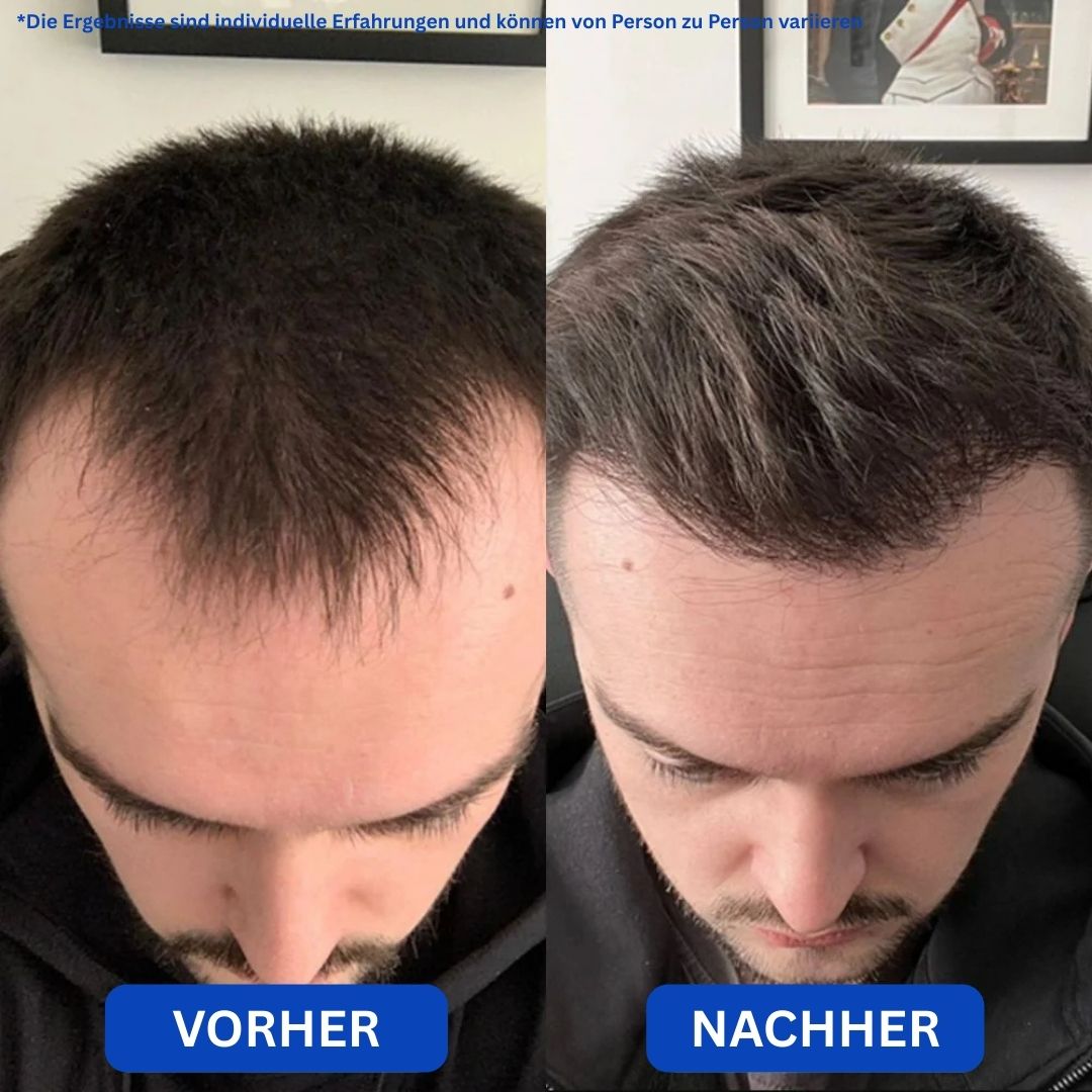 Regenyx™ – Serum für volles Haar